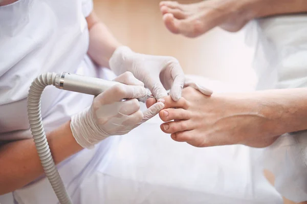 Hardware Pedicure Médica Com Aparato Perfuração Arquivo Unhas Paciente Tratamento — Fotografia de Stock