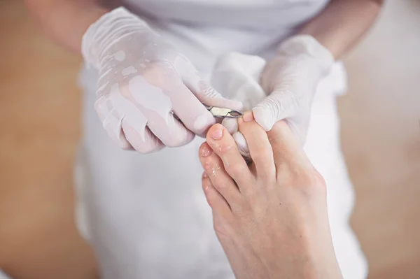 Profesionální Lékařská Pedikúra Zblízka Pomocí Nástroje Nůžky Nehty Pacient Chiropodistického — Stock fotografie