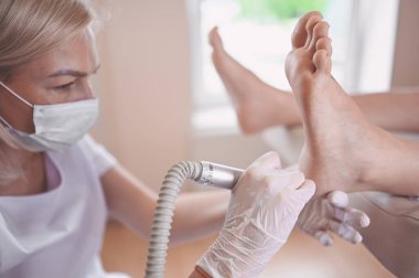 Ayak bileme ekipmanları kullanan ve ayak pedikürü için işlem cilası yapan pediatrist doktor. Beyaz eldivenli Podoloji Güzellik Uzmanı müşteri bacaklarını nasırdan ve mısırdan profesyonel aletlerle temizliyor.