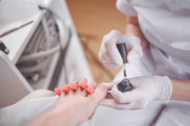 Pedikürcü, ayak parmağı ayırıcı kullanarak hasta bacaklarına beyaz oje sürüyor. Profesyonel tıbbi pedikür prosedürü. SPA salonunda ayak tedavisi. Ayak hastalıkları kliniği. Beyaz eldivenli güzellik uzmanı elleri