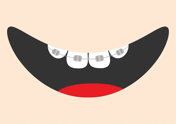 Boca con lengua y ortodoncia. Cara sonriente. Un aparato dental sano. Parte del cuerpo. Lindo personaje de dibujos animados. Higiene dental oral Icono de cuidado dental infantil. Fondo de bebé. Diseño plano — Vector de stock