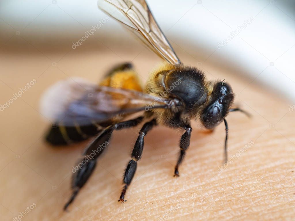 Bee stop on the skin , Bee stings in the hand of a person 