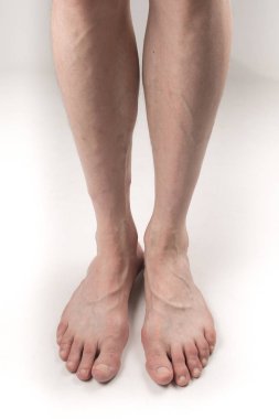 beyaz bir arka plan üzerinde varisli bir adamın çıplak bacakları