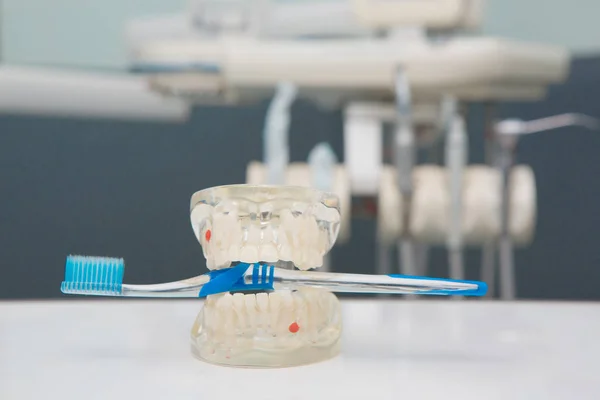 Modelo de dentes dentários e ferramenta odontológica — Fotografia de Stock