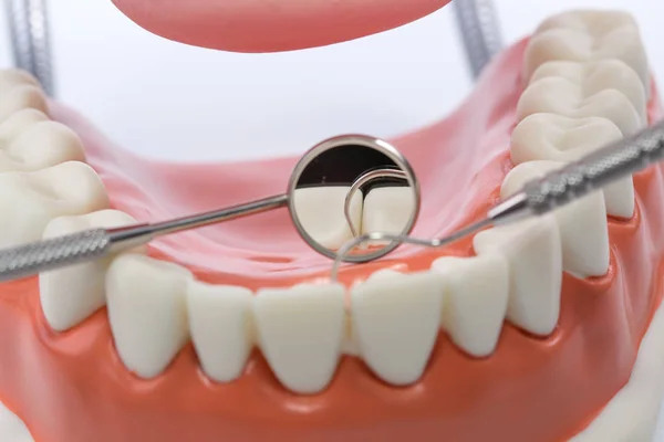 Modelo dental, modelo de dentes no fundo branco — Fotografia de Stock