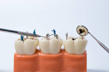 İnsanlar beyaz arka plan, minyatür üzerinde diş modeli temizlemek için