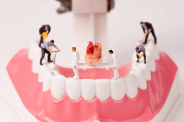 minyatür insanlar ve diş modeli, diş bakımı kavramı