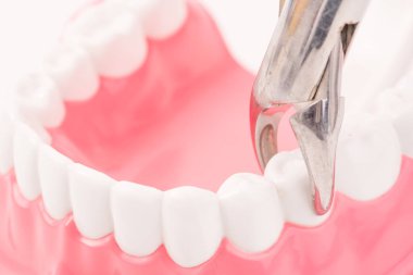 diş modeli ve diş aracı