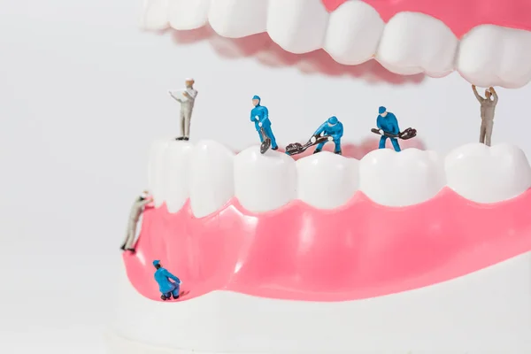 People to clean tooth model — Stock Photo, Image