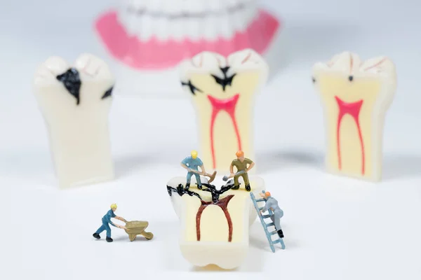 Modelo de diente limpio de personas en miniatura, concepto médico — Foto de Stock