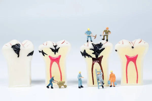 Miniaturowy ludzie czyste zęby modelu, koncepcja medyczna — Zdjęcie stockowe