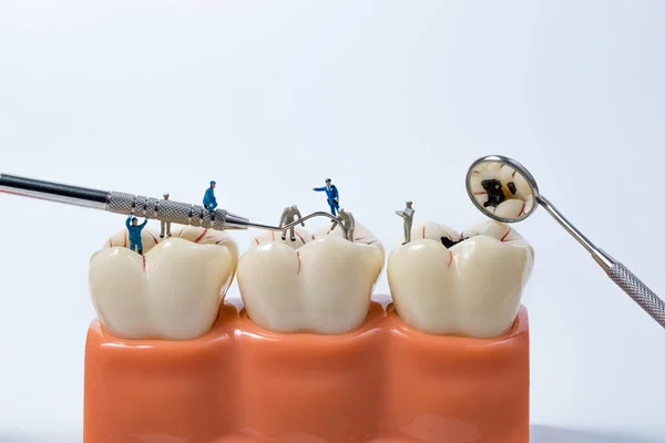 Pessoas para limpar o modelo de dente no fundo branco, em miniatura — Fotografia de Stock