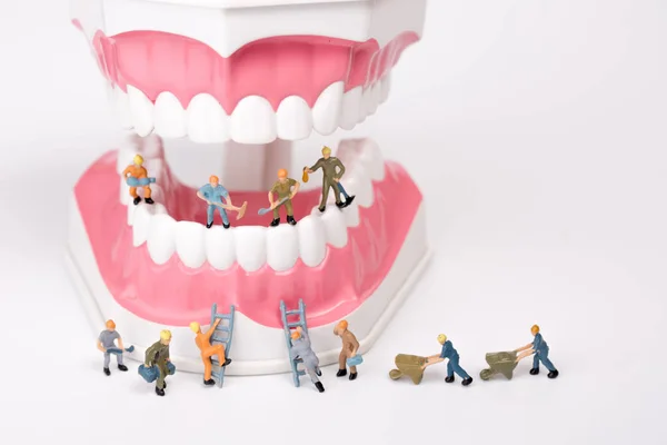 Miniatura de pessoas modelo de dente limpo, conceito médico — Fotografia de Stock