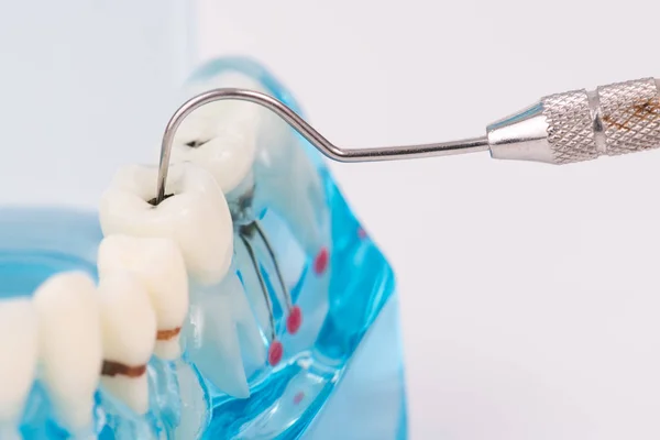 Objeto modelo dental com ferramenta odontológica — Fotografia de Stock