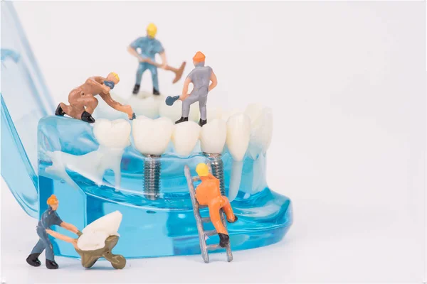 Pessoas em miniatura limpar dente ou modelo dental, conceito médico — Fotografia de Stock