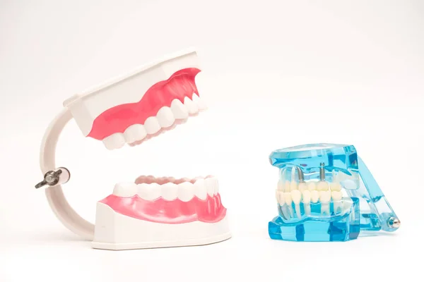 Modelo dental em fundo branco, conceito de cuidados dentários — Fotografia de Stock