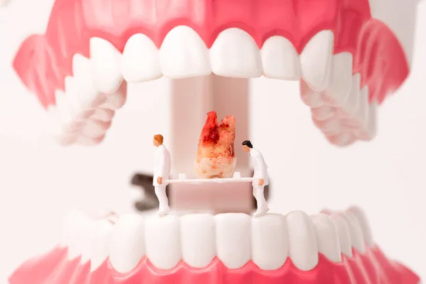 miniature people clean tooth or dental model,dental care  concept