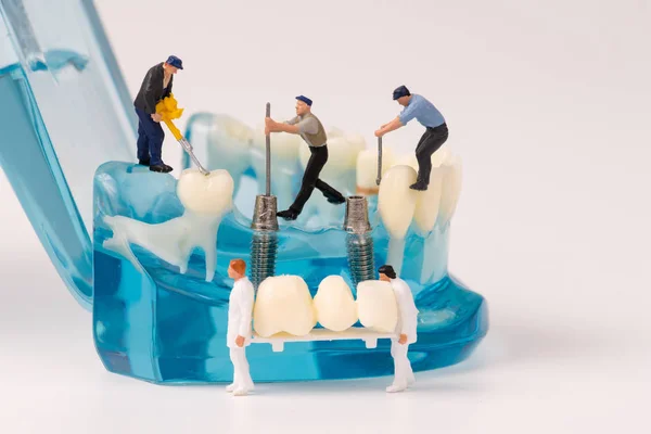 Pessoas em miniatura e modelo odontológico, conceito de atendimento odontológico — Fotografia de Stock