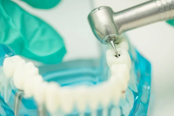 Modelo odontológico e ferramenta odontológica na clínica odontológica — Fotografia de Stock