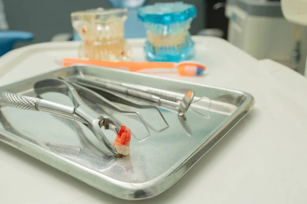 牙科模型和牙科工具，以去除牙科诊所的牙科 — 图库照片