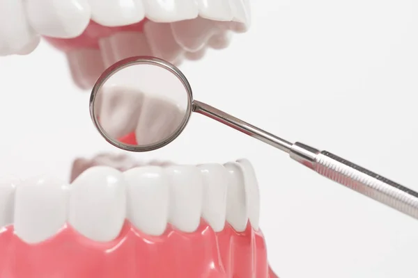 Modelo dentário e ferramenta odontológica — Fotografia de Stock