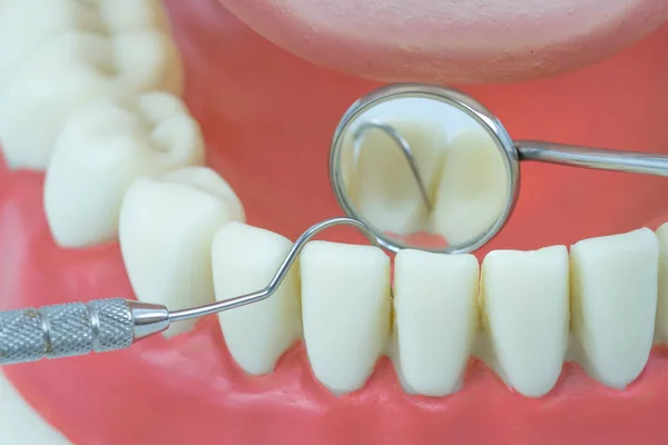 Закрыть объект стоматологической модели с помощью стоматологического инструмента, зеркала, крючка — стоковое фото