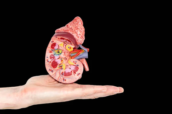 Plat Vrouwelijke Hand Weergegeven Model Met Doorsnede Van Menselijke Nieren — Stockfoto
