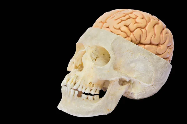 Calavera Humana Con Modelo Cerebro Aislado Sobre Fondo Negro —  Fotos de Stock