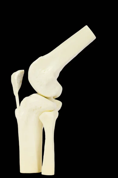 Kolana Wspólnego Modelu Ludzkiej Nogi Białym Czarnym Tle — Zdjęcie stockowe