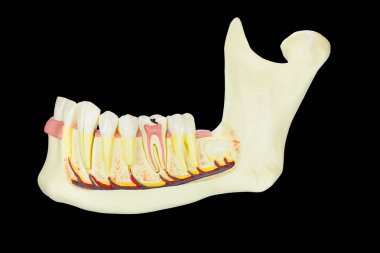Siyah arka planda dişlerle insan çene kemiği modeli 