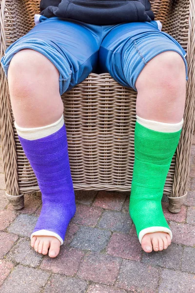 Ragazzo si siede con due gambe di gesso colorate — Foto Stock