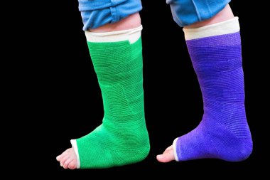 Siyah arka plan üzerinde iki renkli alçı bacak