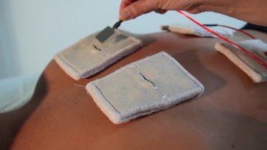 Refleksoterapist elektrostimülasyon için hastalara elektrotlar tamir eder.yakın çekim