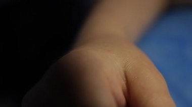 Akupunktur.Kuru biçme. Hastaların bileğine iğne batırıp yakın çekim. Tetik noktası terapisi. Geleneksel Çin tıbbı