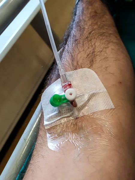 Detail Van Een Medisch Infuus Een Arm — Stockfoto