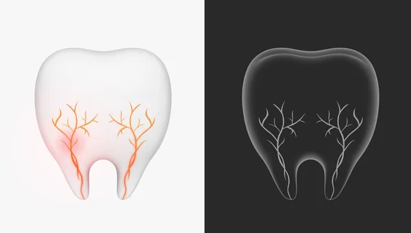 Tooth Concept Nerve Tooth — Stock Photo, Image