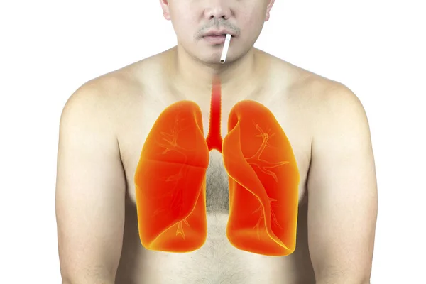 Cuidado Salud Pulmonar Por Rayos Humanos —  Fotos de Stock