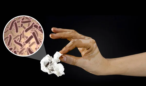 Βρώμικο Χέρι Μικρόβια Και Βακτήρια — Φωτογραφία Αρχείου