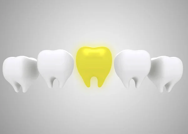 Tooth Concept Gold Tooth — Stock Photo, Image