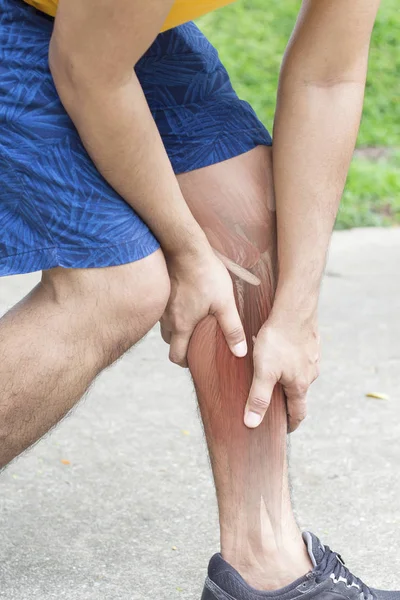 Beinmuskelschmerzen Weißer Hintergrund — Stockfoto