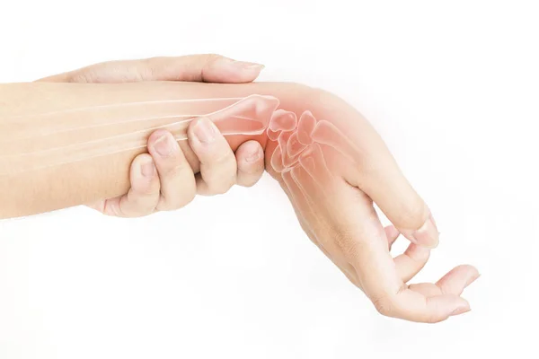 Verletzung Der Handgelenkknochen Weißer Hintergrund Schmerzen Handgelenk — Stockfoto