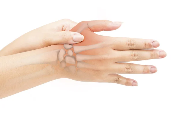 Hand Botten Letsel Witte Achtergrond Hand Pijn — Stockfoto
