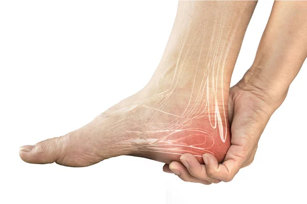 Heel Muscle Pain Ray Healthcare — Stock Photo, Image