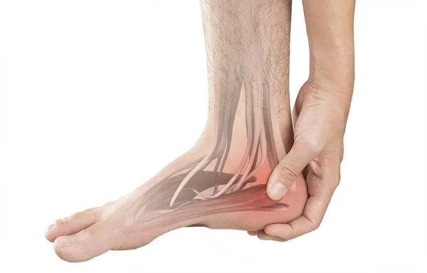 脚跟肌肉疼痛 白色背景脚跟损伤 — 图库照片