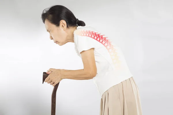 Старая Азиатская Женщина Стоять Чувствовать Боль Позвоночнике Кости — стоковое фото