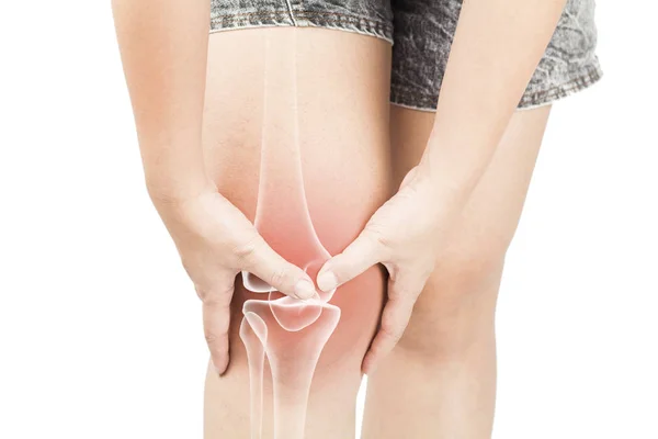 Knee Bones Pain White Background Knee Injury — Stock Photo, Image