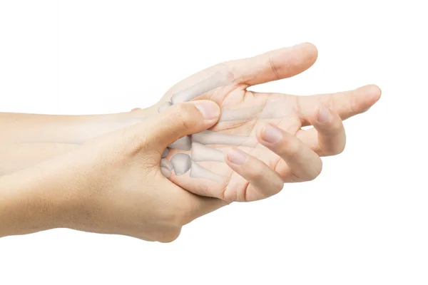 Verletzung Der Handgelenkknochen Weißer Hintergrund Schmerzen Handgelenk — Stockfoto