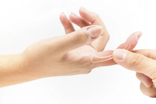 Πόνος Στα Οστά Του Δακτύλου Λευκό Φόντο Τραυματισμό Δακτύλων — Φωτογραφία Αρχείου