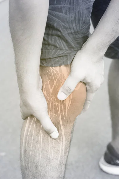 Dor Muscular Joelho Fundo Branco Lesão Joelho — Fotografia de Stock