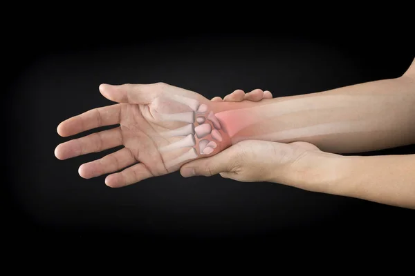 Bilek kemikleri yaralanması beyaz arka plan bilek ağrısı
